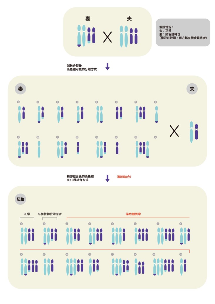 染色體轉位該怎麼辦?