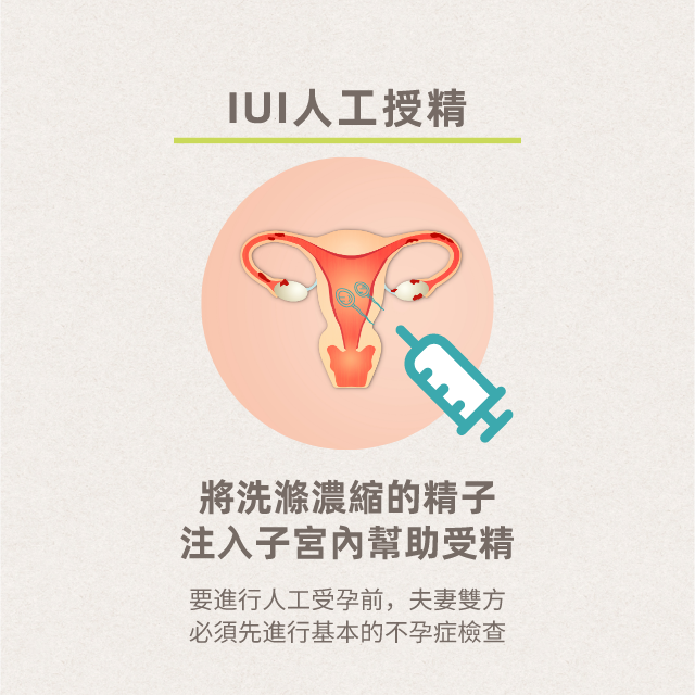 a 人工授精(微信号ivf2022)人工授精地址官网资讯价格费用代孕试管助孕代怀yed em Promoção na Shopee Brasil  2023